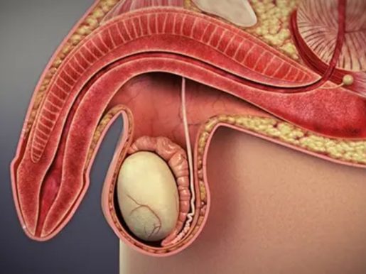 Erectile Dysfunction & Premature Ejaculation